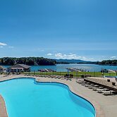Community Pools & Beach: Smith Mountain Lake Condo