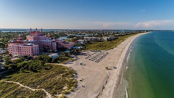 The Don CeSar