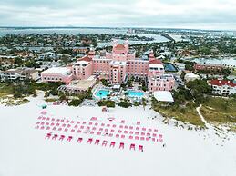 The Don CeSar
