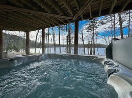 Perley Pond Lodge Limit 14 4 Bedroom Villa