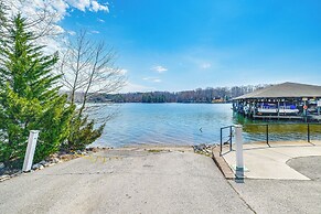 Resort Amenities & Beach Access: Huddleston Condo