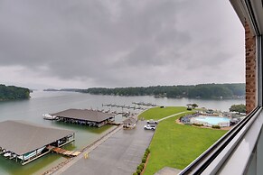 Resort Amenities & Beach Access: Huddleston Condo