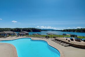 Resort Amenities & Beach Access: Huddleston Condo