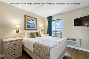 Beacher's Lodge Oceanfront Suites