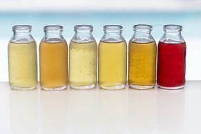 SALT of Palmar, an adult-only boutique Hotel