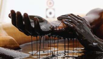 Chinar Health Hotel Naftalan