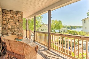 Sunny Glen Burnie Home - On-site Water Access
