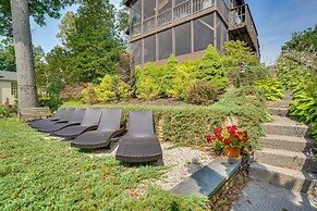 Lakefront Queensbury Home: Kayaks + Boat Dock